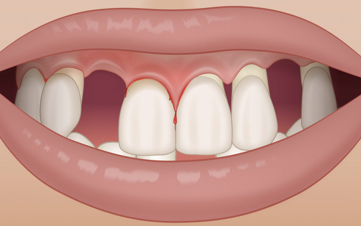 Problems with appearance (esthetics)