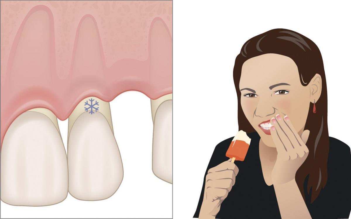 Possible side effects of periodontal treatment